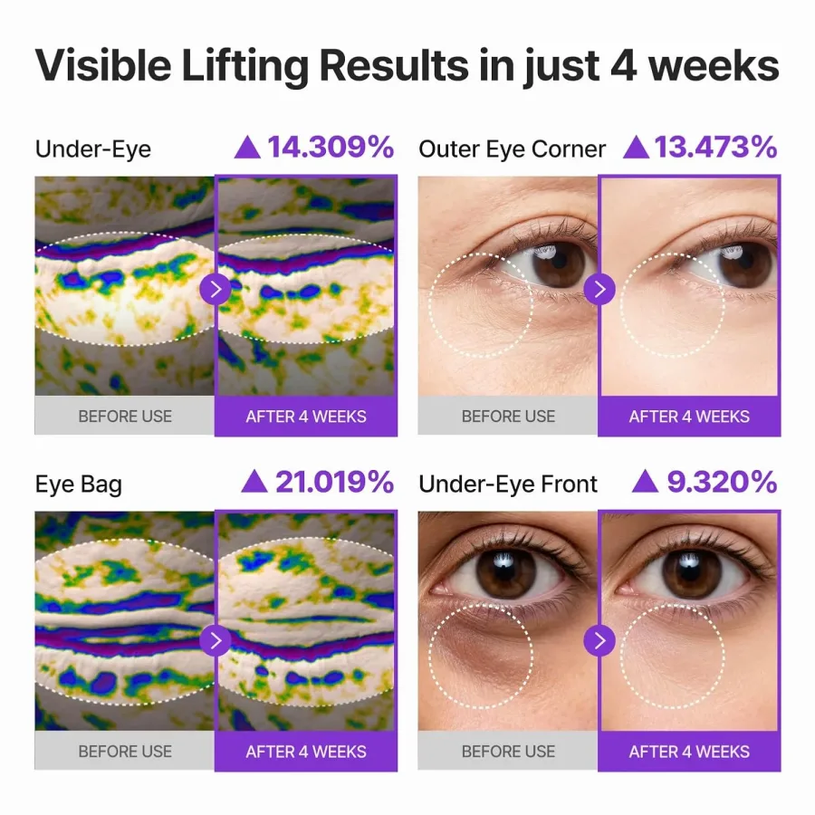 CENTELLIAN 24 eye cream applied around the eye contour area